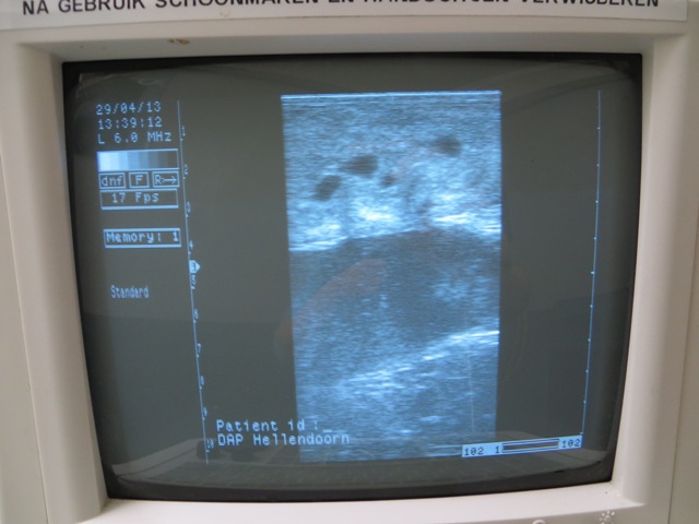 Gynaecologie (voortplanting)