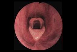 Endoscopie